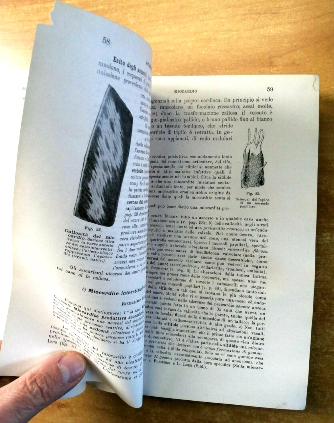 Trattato Di Anatomia Patologica Speciale Parte 1 - Kaufmann 1929 Vallardi 1030K