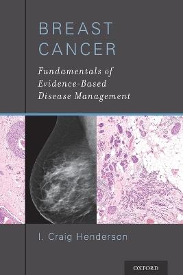 Breast Cancer: Fundamentals of Evidence-Based Disease Management - I. Craig Henderson - cover