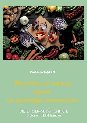 Recettes et menus après un pontage coronarien.: Volume 2. - Cédric Menard - cover