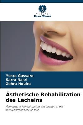 Ästhetische Rehabilitation des Lächelns - Yosra Gassara,Sarra Nasri,Zohra Nouira - cover