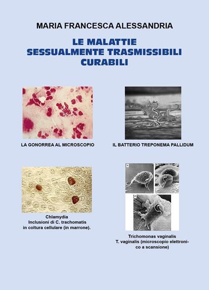Le malattie sessualmente trasmissibili curabili - Maria Francesca Alessandria - copertina